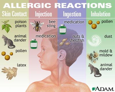 allergies allergies